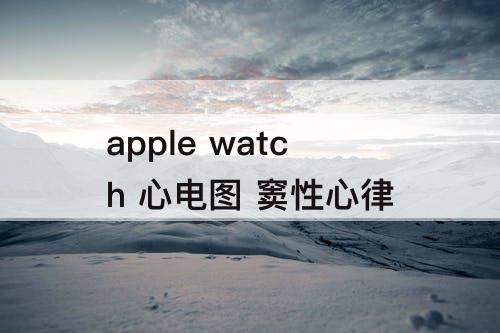 apple watch 心电图 窦性心律